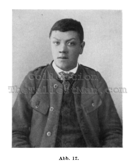 Adam Rainer - The tallest man Austria