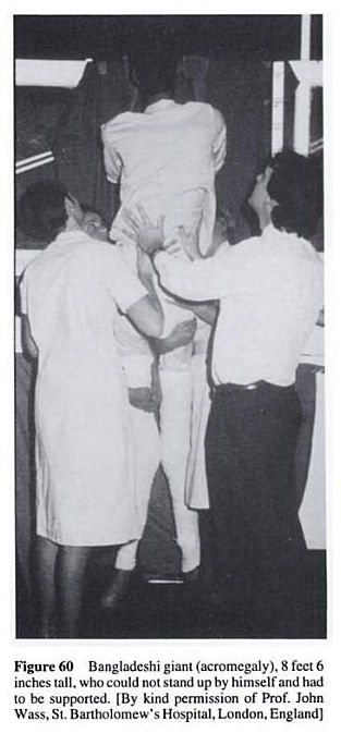 Parimal Chandra Barman - The tallest man Bangladesh